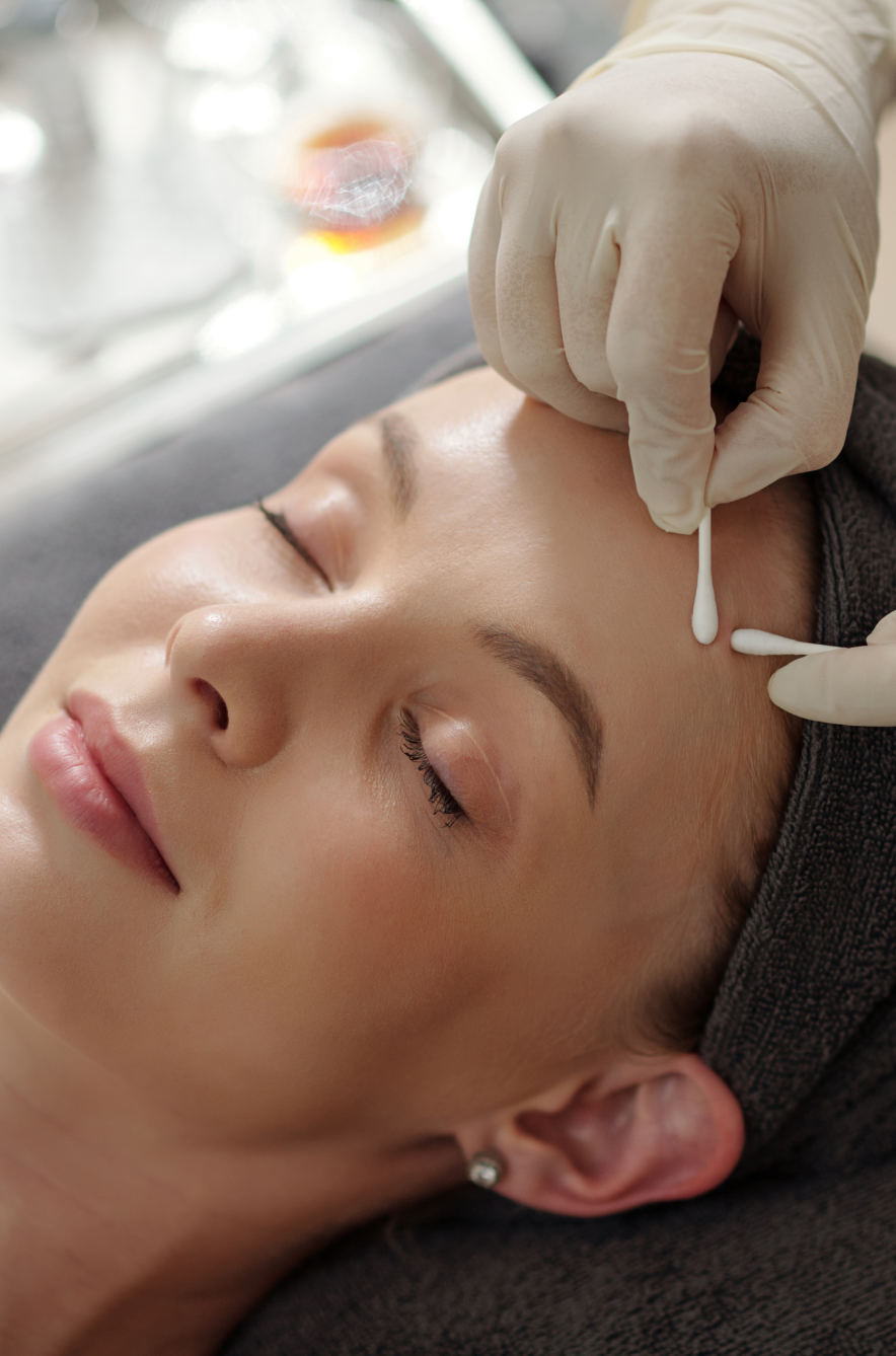 acne gezichtsbehandeling enschede